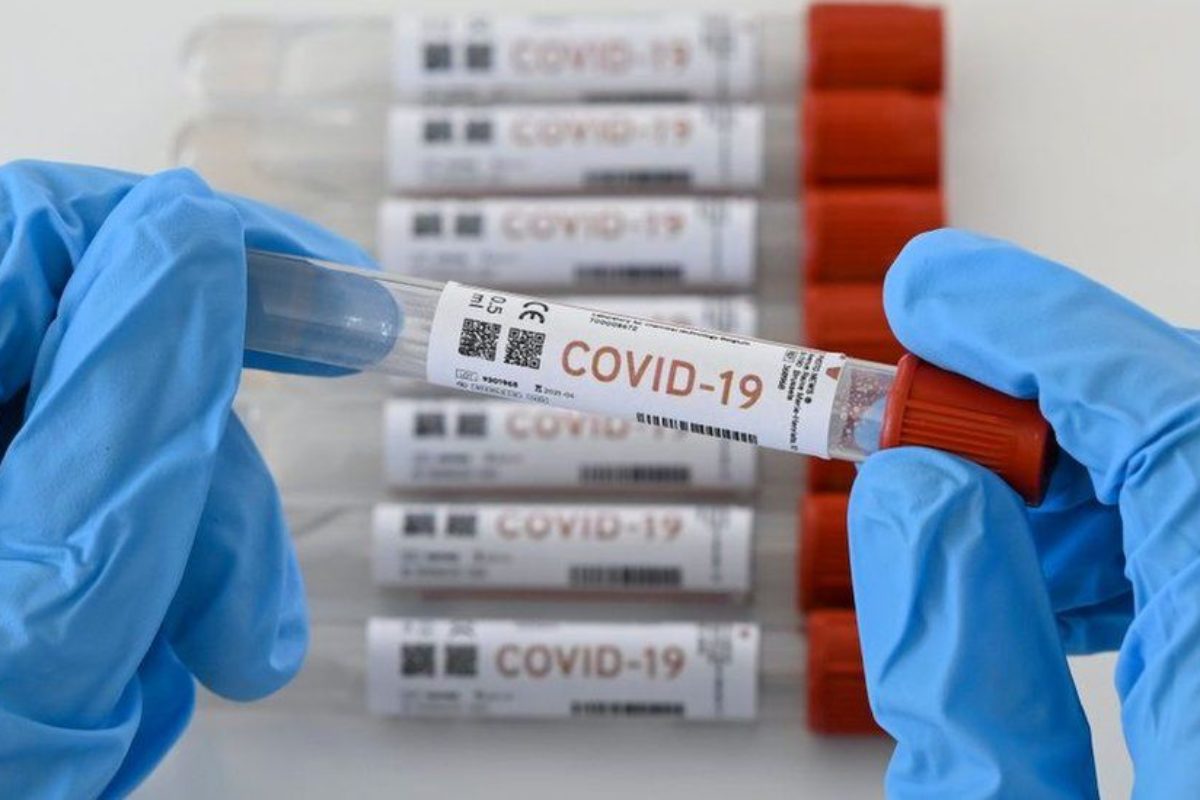 Salud no publica actualización de casos Covid-19 desde anteayer
