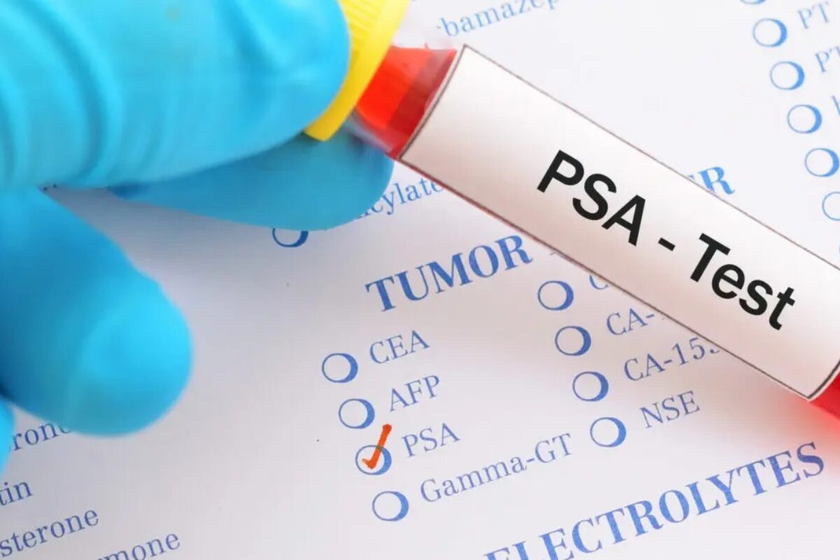 Hasta el 95% de casos de cáncer de próstata es prevenible: El papel crucial del PSA